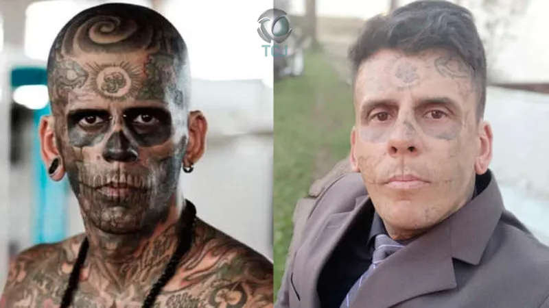 “Homem mais tatuado do Brasil” mostra rosto após sessão de remoção a laser