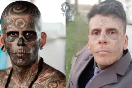 “Homem mais tatuado do Brasil” mostra rosto após sessão de remoção a laser